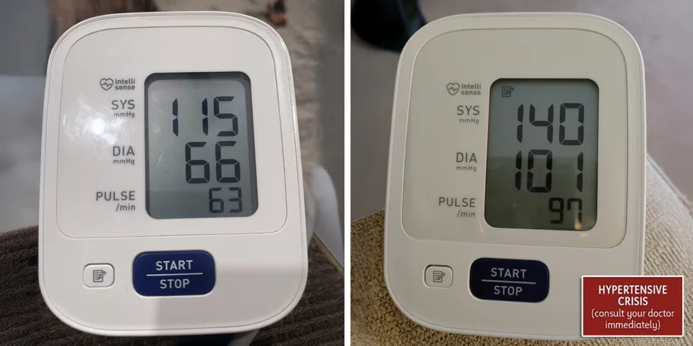 Couple sleeping issues